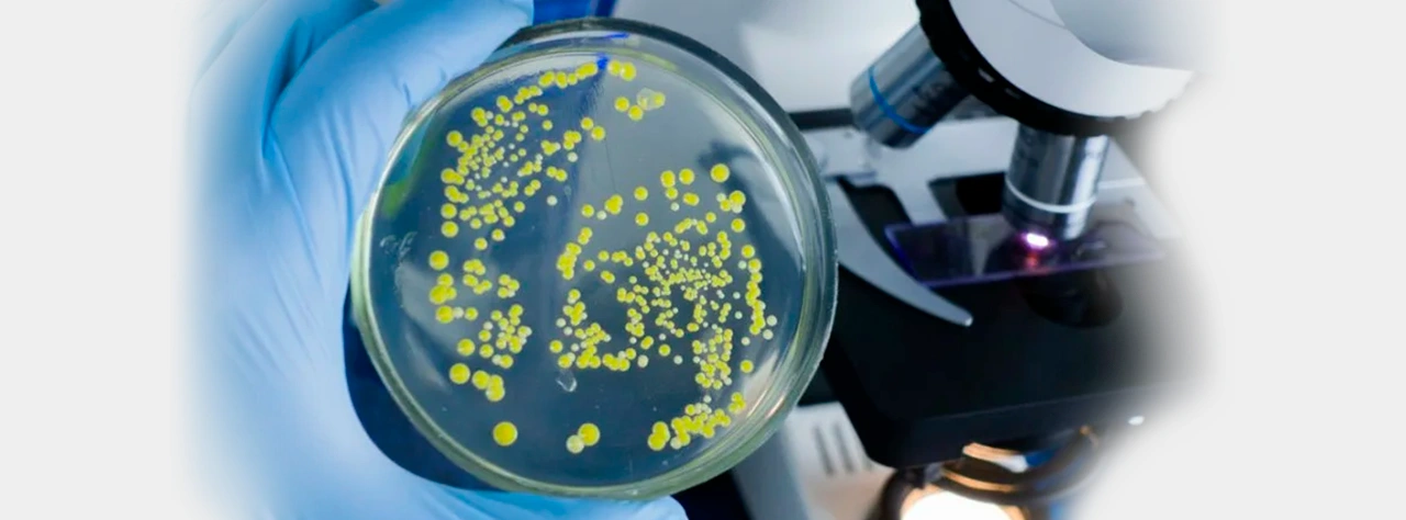Цистит, вызванный кишечной палочкой E.coli